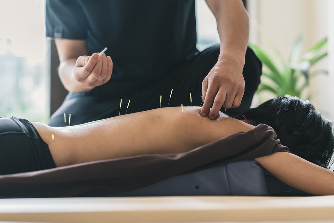 5ed50d299f6ded10ec68a495_acupuncture pain management-p-1080