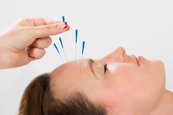 acupuncture_a4b1b8aa63de0b660f29ecba815108b6798fe631